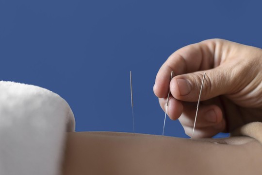 Bild von «Puls Chat» zu Komplementärmedizin war teilweise meinungsverfälschend