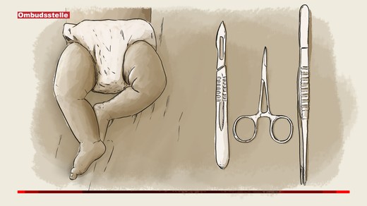 Bild von Knabenbeschneidung – zwei gegensätzliche Beanstandungen