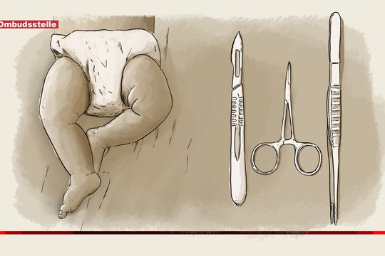 Bild von Knabenbeschneidung – zwei gegensätzliche Beanstandungen