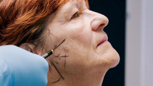 Bild von «DOK»: Das optimierte Gesicht